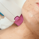 Non-surgical options for youthful, natural look