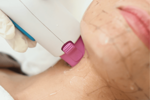 Non-surgical options for youthful, natural look