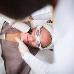 Laser therapy for long-standing scars at Facial Care Centre